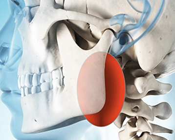 Parapharyngeal Tumors Treatment in Delhi